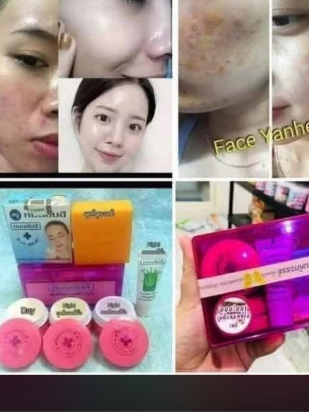 Dr Yanhee Made in Thailand blue set and purple set for pigmentation/anti aging
